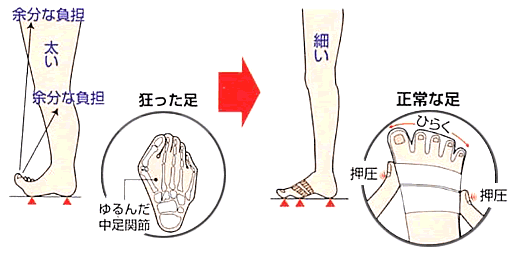 足が太い理由