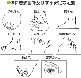 体に悪影響を及ぼす不安定な足裏