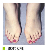 30代女性