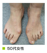 50代女性