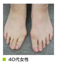 40代女性