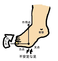 不安定な足裏