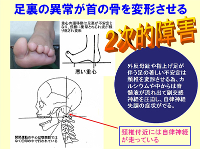 二次的障害について