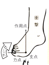 衝撃とねじれ