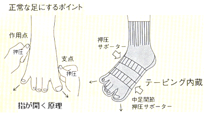 正常な足にするポイント