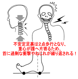 不安定な足裏から起こる異常の解説