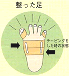 テーピングで整った足