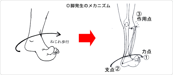 O脚発生のメカニズム