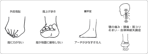 足裏の免震機能の低下例