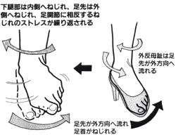 足関節に相反するねじれのストレスが繰り返される