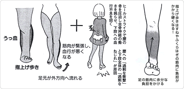 足が冷える原因