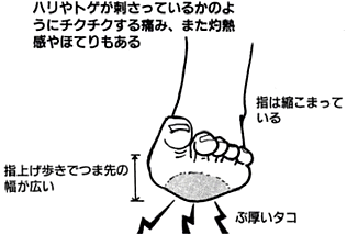 タコと魚の目