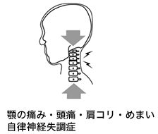 首への負担図解