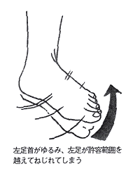 左足首が弛んでいる図