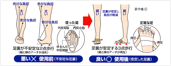 テーピングの仕様前後イメージ