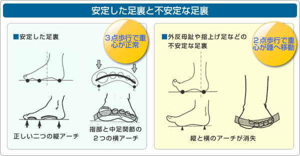 安定した足裏と不安定な足裏