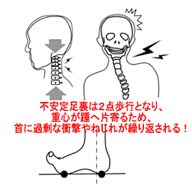 不安定な足裏と首の関係