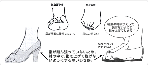 悪い足の大本