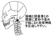 関節の変形や歪みと自律神経の関係性