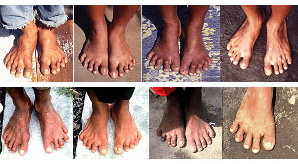 裸足で生活している人たちの足の写真