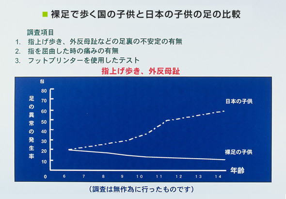 裸足で歩く国の子供と日本の子供の足の比較