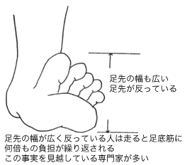 足裏の痛みの原因