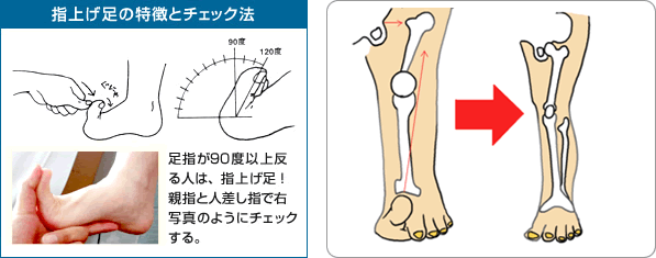 本当の原因