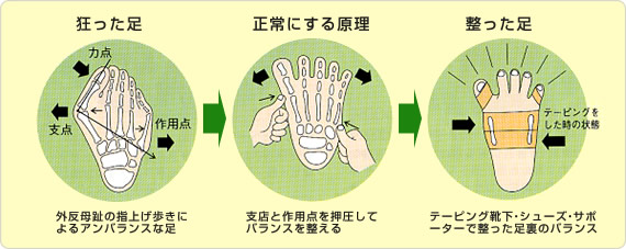 テーピングの流れ