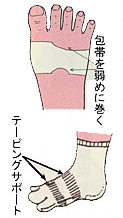包帯とテーピング靴下の併用