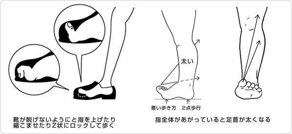 原因解説