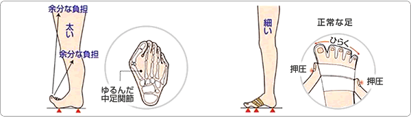 不安定な足と正常な足