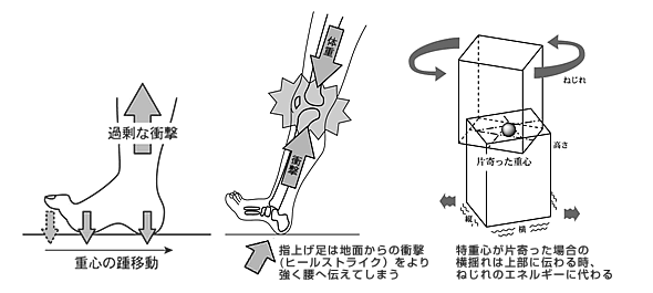 新スポーツ障害のメカニズム