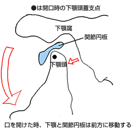 説明図３