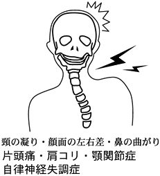 首への負担からくる不調