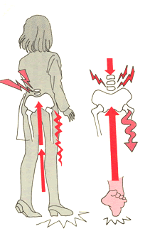 衝撃が腰部に伝わる図解