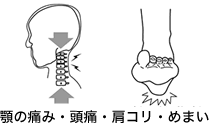 顎の痛み、頭痛肩こり、めまい