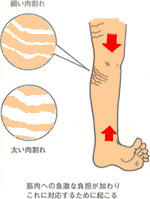 お腹 横線