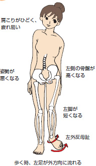 の だけ 体 不調 左側