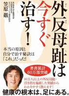 外反母趾は今すぐ治す！本当の原因と自分で治す秘訣は「これ」だった！