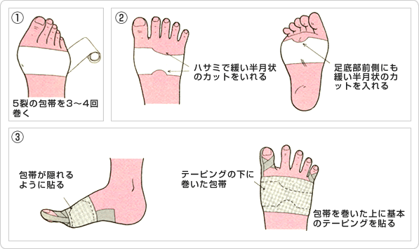 「痛みのある」場合のテーピング法概要