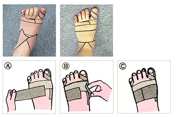 踵テープと基本アーチテープ2の貼り方