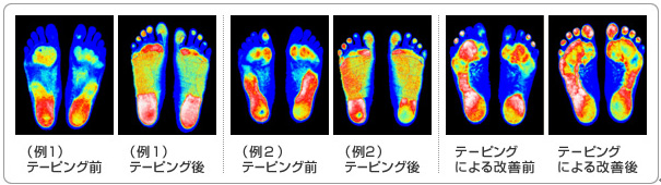 施術前後の写真