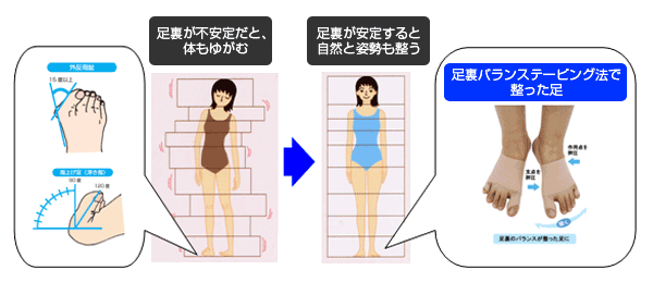 足裏が不安定だと体もゆがむ