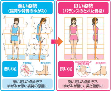 悪い姿勢と良い姿勢